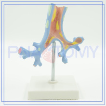 PNT-0751 Hot sale bronchi and bronchopulrnonary segments model for medical university